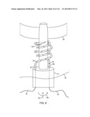 METHOD FOR PROVIDING SURGICAL ACCESS diagram and image