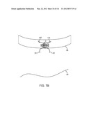 METHOD FOR PROVIDING SURGICAL ACCESS diagram and image