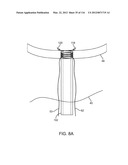 METHOD FOR PROVIDING SURGICAL ACCESS diagram and image