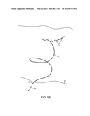 METHOD FOR PROVIDING SURGICAL ACCESS diagram and image