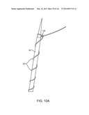 METHOD FOR PROVIDING SURGICAL ACCESS diagram and image