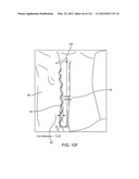 METHOD FOR PROVIDING SURGICAL ACCESS diagram and image