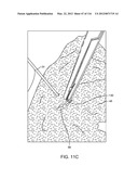 METHOD FOR PROVIDING SURGICAL ACCESS diagram and image