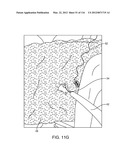 METHOD FOR PROVIDING SURGICAL ACCESS diagram and image