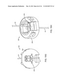 METHOD FOR PROVIDING SURGICAL ACCESS diagram and image