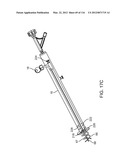 METHOD FOR PROVIDING SURGICAL ACCESS diagram and image