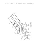 METHOD FOR PROVIDING SURGICAL ACCESS diagram and image