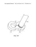 METHOD FOR PROVIDING SURGICAL ACCESS diagram and image