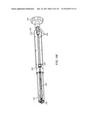 METHOD FOR PROVIDING SURGICAL ACCESS diagram and image