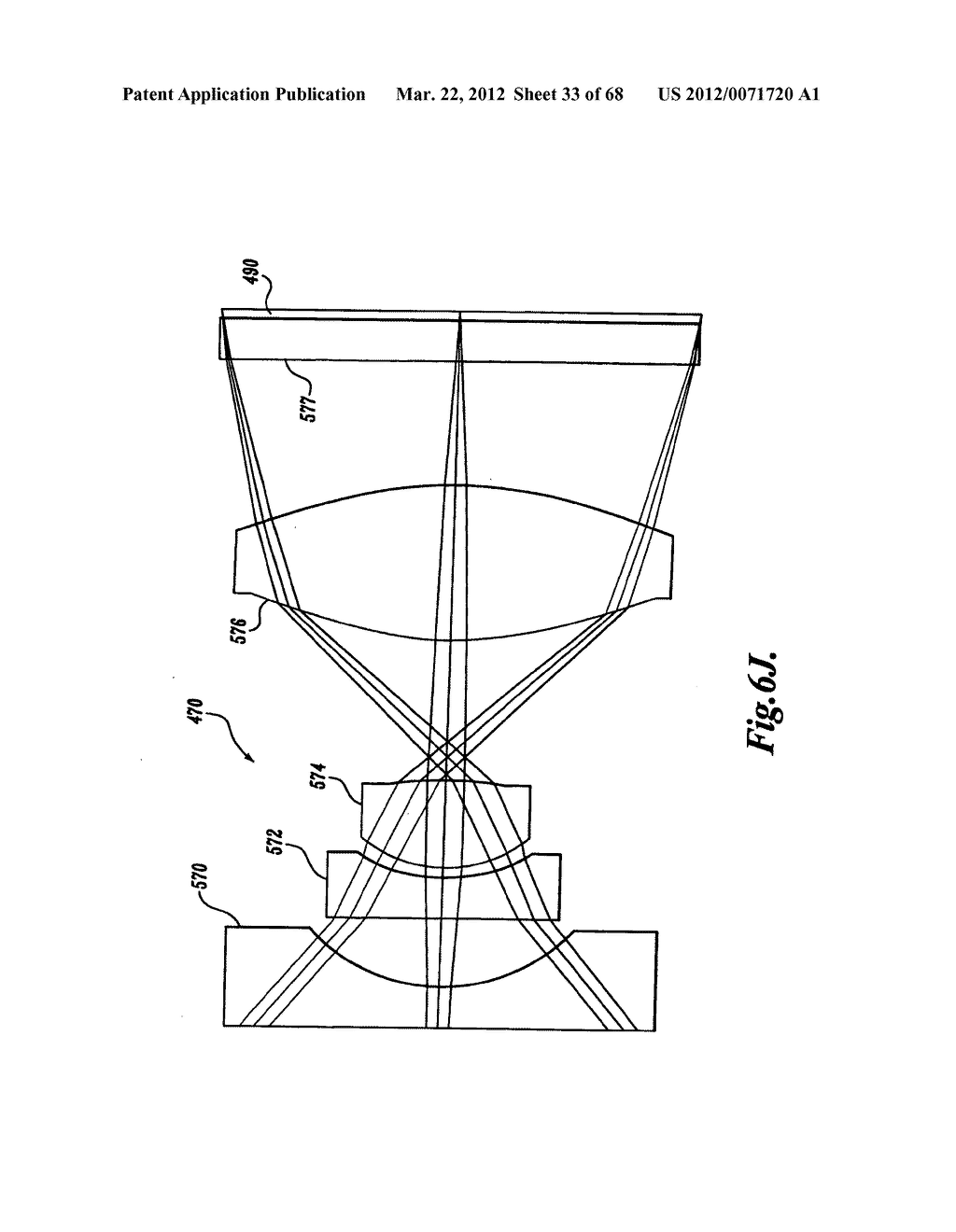 FORCE FEEDBACK CONTROL SYSTEM FOR VIDEO ENDOSCOPE - diagram, schematic, and image 34