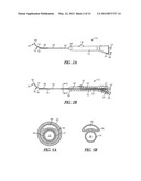 METHOD AND ARTICLES FOR TREATING THE SINUS SYSTEM diagram and image