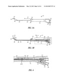 METHOD AND ARTICLES FOR TREATING THE SINUS SYSTEM diagram and image