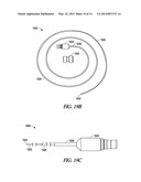 METHOD AND ARTICLES FOR TREATING THE SINUS SYSTEM diagram and image