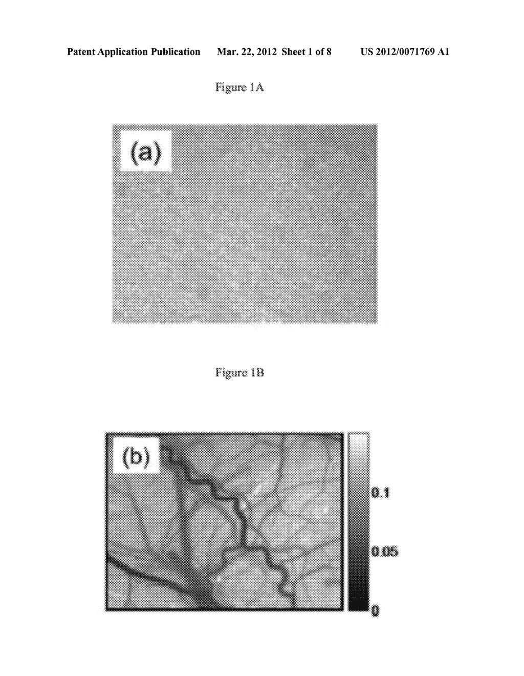 METHODS OF PRODUCING LASER SPECKLE CONTRAST IMAGES - diagram, schematic, and image 02