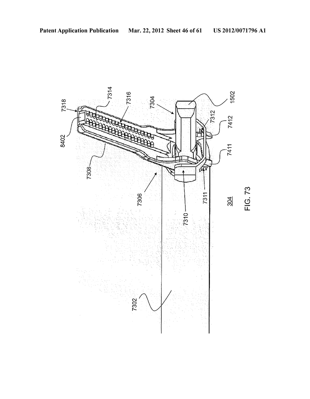 Battery-Powered Hand-Held Ultrasonic Surgical Cautery Cutting Device - diagram, schematic, and image 48