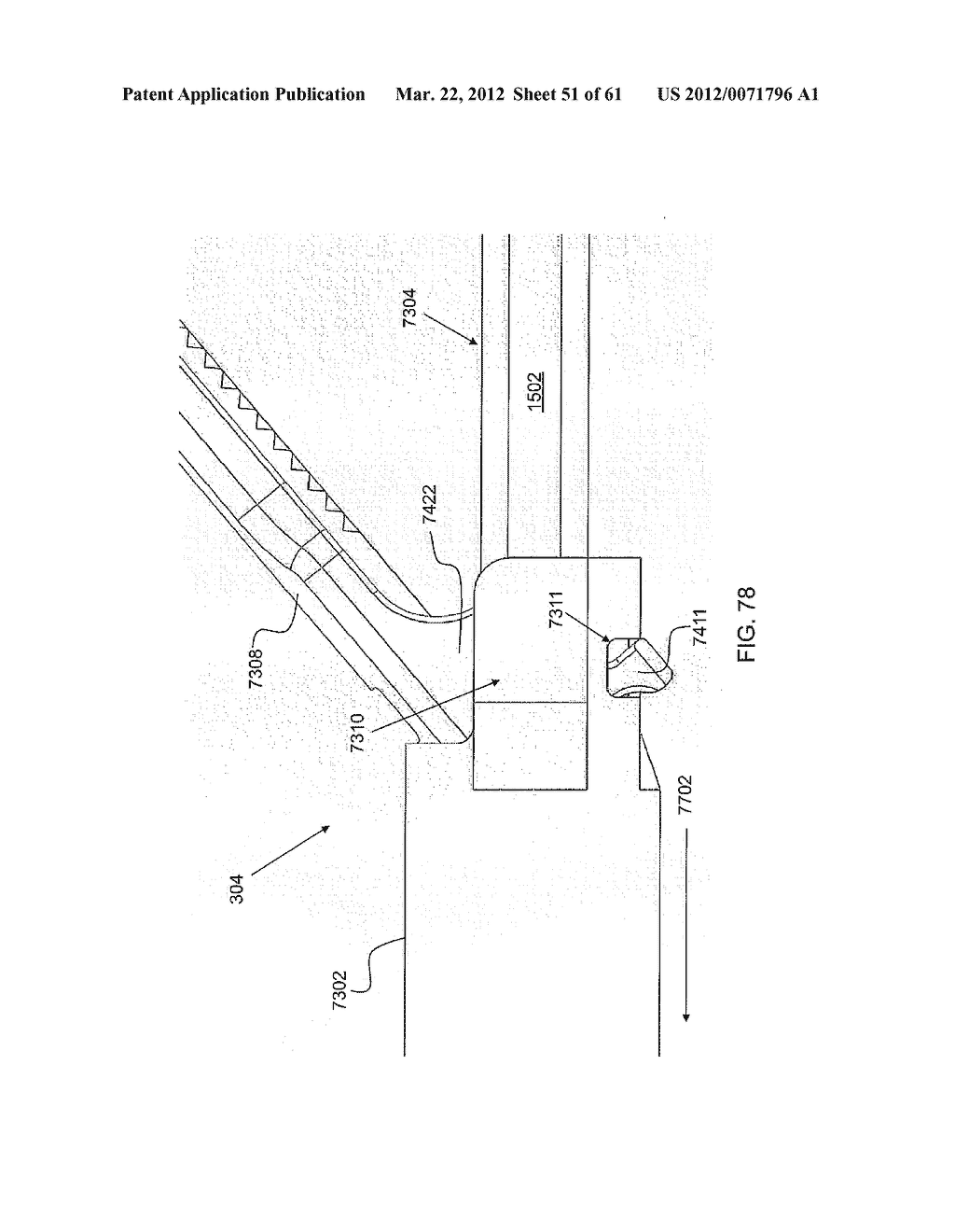 Battery-Powered Hand-Held Ultrasonic Surgical Cautery Cutting Device - diagram, schematic, and image 53