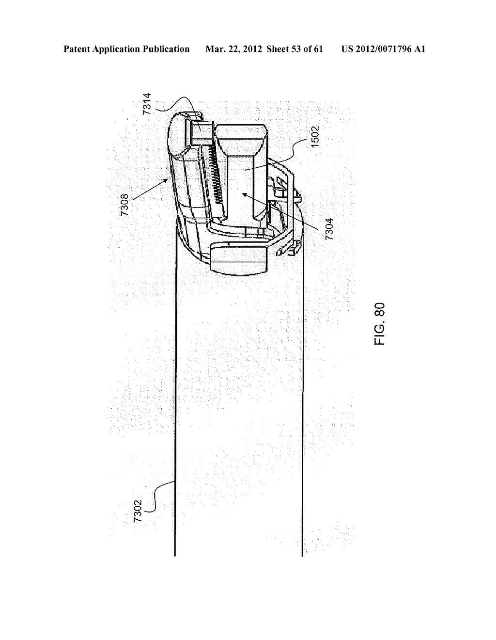 Battery-Powered Hand-Held Ultrasonic Surgical Cautery Cutting Device - diagram, schematic, and image 55