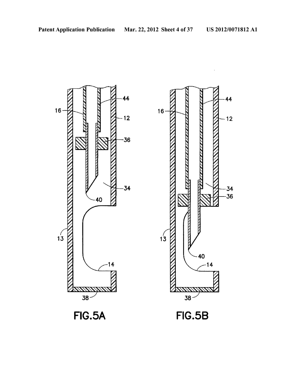 Methods and Systems for Submucosal Implantation of a Device for Diagnosis     and Treatment with a Therapeutic Agent - diagram, schematic, and image 05