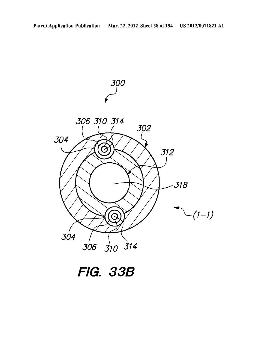 SYSTEMS AND METHODS FOR MANIPULATING AN ELONGATE MEMBER - diagram, schematic, and image 39