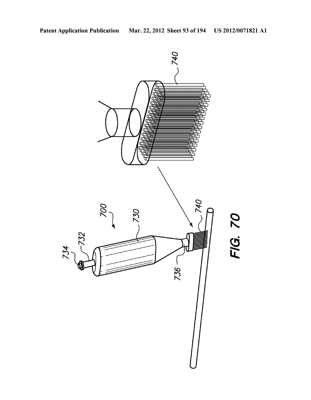 SYSTEMS AND METHODS FOR MANIPULATING AN ELONGATE MEMBER - diagram, schematic, and image 94