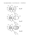 Devices, Systems and Methods for Treating Disorders of the Ear, Nose and     Throat diagram and image