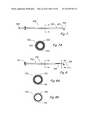 Devices, Systems and Methods for Treating Disorders of the Ear, Nose and     Throat diagram and image