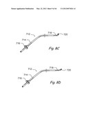 Devices, Systems and Methods for Treating Disorders of the Ear, Nose and     Throat diagram and image