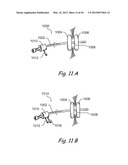 Devices, Systems and Methods for Treating Disorders of the Ear, Nose and     Throat diagram and image