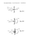 Devices, Systems and Methods for Treating Disorders of the Ear, Nose and     Throat diagram and image