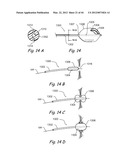 Devices, Systems and Methods for Treating Disorders of the Ear, Nose and     Throat diagram and image