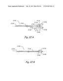 Devices, Systems and Methods for Treating Disorders of the Ear, Nose and     Throat diagram and image