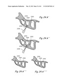 Devices, Systems and Methods for Treating Disorders of the Ear, Nose and     Throat diagram and image