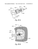 Devices, Systems and Methods for Treating Disorders of the Ear, Nose and     Throat diagram and image