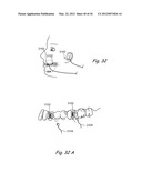 Devices, Systems and Methods for Treating Disorders of the Ear, Nose and     Throat diagram and image