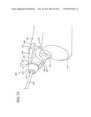 Dual Chamber Syringe With Retractable Needle diagram and image