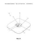 CONTROLLED NEGATIVE PRESSURE APPARATUS AND ABSORBENCY MECHANISM diagram and image