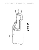 ENDOVASCULAR DEVICES AND METHODS diagram and image