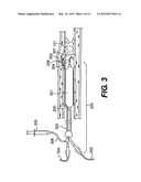 ENDOVASCULAR DEVICES AND METHODS diagram and image