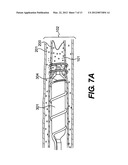 ENDOVASCULAR DEVICES AND METHODS diagram and image