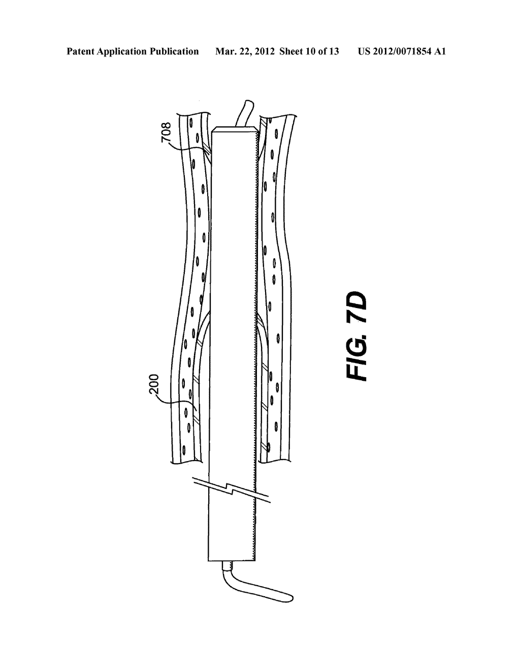 ENDOVASCULAR DEVICES AND METHODS - diagram, schematic, and image 11