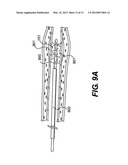 ENDOVASCULAR DEVICES AND METHODS diagram and image