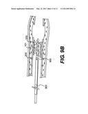 ENDOVASCULAR DEVICES AND METHODS diagram and image