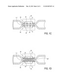 ELECTROSURGICAL TISSUE SEALING AUGMENTED WITH A SEAL-ENHANCING COMPOSITION diagram and image