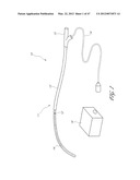 SYSTEMS FOR TREATING A HOLLOW ANATOMICAL STRUCTURE diagram and image