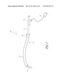 SYSTEMS FOR TREATING A HOLLOW ANATOMICAL STRUCTURE diagram and image