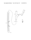 SYSTEMS FOR TREATING A HOLLOW ANATOMICAL STRUCTURE diagram and image