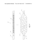 SYSTEMS FOR TREATING A HOLLOW ANATOMICAL STRUCTURE diagram and image