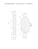 SYSTEMS FOR TREATING A HOLLOW ANATOMICAL STRUCTURE diagram and image