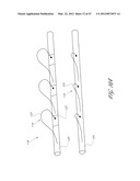 SYSTEMS FOR TREATING A HOLLOW ANATOMICAL STRUCTURE diagram and image