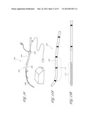 SYSTEMS FOR TREATING A HOLLOW ANATOMICAL STRUCTURE diagram and image